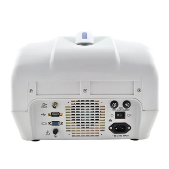  MY-A001-N dijital taşınabilir ultrason / Taşınabilir Ultrason Teşhis Tarayıcı